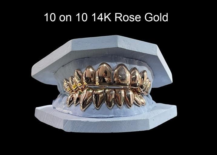 14K Solid Gold Grillz - The Real Jewelry CompanyThe Real Jewelry CompanyGrillz