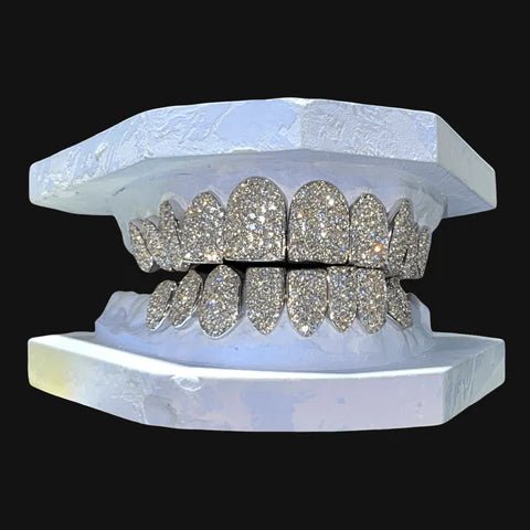 Custom Diamond Grillz - The Real Jewelry CompanyThe Real Jewelry CompanyGrillz